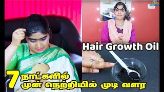 Hair growth tips in tamil | 7 நாளில் முன் நெற்றியில் முடி வளர  Hair Growth oil | STOP Hair Fall