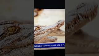 #animalnature #accidents : #threatenedspecies American #crocodile bites 68 year old man; he's OK