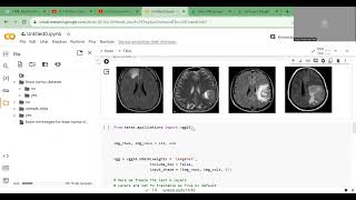 Brain MRI Images classification using InceptionV3 Model