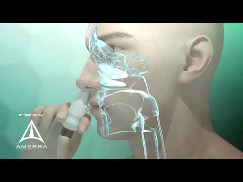 Is fluticasone propionate nasal spray the same as Flonase?
