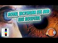 Royal Victorian Eye and Ear Hospital (Your EYEBALLS) 👁️👁️💉😳💊🔊💯✅