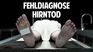 Fehldiagnose Hirntod: Wann ist der Mensch wirklich tot?