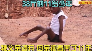 非洲纪录片：38斤11岁男孩，因残疾被父亲遗弃，母亲抱着养了11年