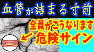 脳の血管が詰まる寸前の人にだけ現れる症状3選と脳卒中を90%予防し業務スーパーで買える血管ツルツルにする最強の朝食と寝たきりリスクを半減させる寝ながら動脈硬化を予防する方法