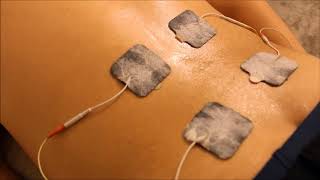 Terapia con electro estimulación para ciatica, dolor de espalda y más