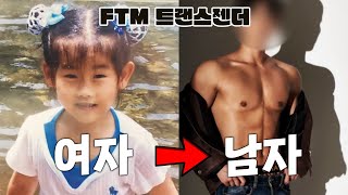 여자에서 남자가 된다면?ㅣFTM트랜스젠더의 모든것ㅣ성전환수술