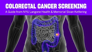 Colorectal Cancer Screening: A Guide from NYU Langone Health \u0026 Memorial Sloan Kettering