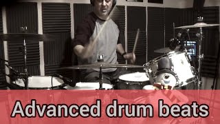 5 Advanced Drum Beats To Practice