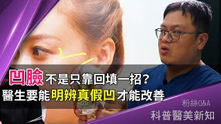 超災難！凹凹臉狂填補竟成大餅臉  何謂真凹陷、假凹陷...搞清楚了嗎？ 科普醫美新知 107-20200619