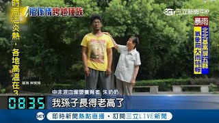 怎麼洗都洗不乾淨?阿嬤拾嬰回家養 送醫才知道是\