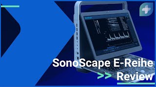 SonoScape E3 in der Review | E-Reihe mit E1, E2, E3 | Was können Laptop Ultraschallgeräte leisten?