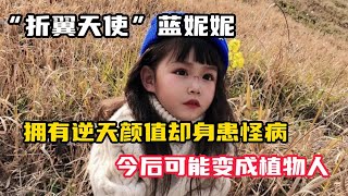 “折翼天使”蓝妮妮，拥有逆天颜值却身患怪病，今后可能变植物人