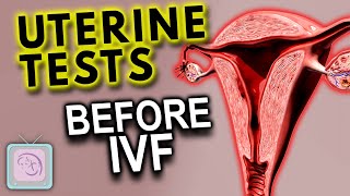 How good is your uterus for IVF? Essential fertility tests for IVF success