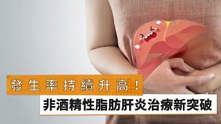 【余明隆醫師】【黃志富醫師】發生率持續升高！　非酒精性脂肪肝炎治療新突破｜健康醫療網