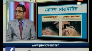 Hitguj | Dr R S Sonawane | On Psoriasis Patient Food And Daily Program | 7th April 2017