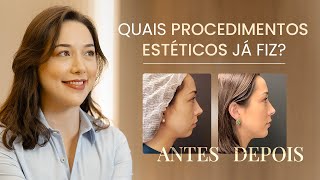 Procedimentos para deixar o rosto harmônico | Meu antes e depois