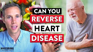 Can You Reverse Heart Disease? + The Link Between Heart Disease & Dental Health | Mastering Diabetes