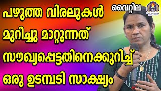 പഴുത്ത വിരലുകൾ മുറിച്ചു മാറ്റുന്നത് സൗഖ്യപ്പെട്ടതിനെക്കുറിച്ച് ഒരു ഉടമ്പടി സാക്ഷ്യം