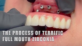 The Process of Terrific Full Mouth Zirconia