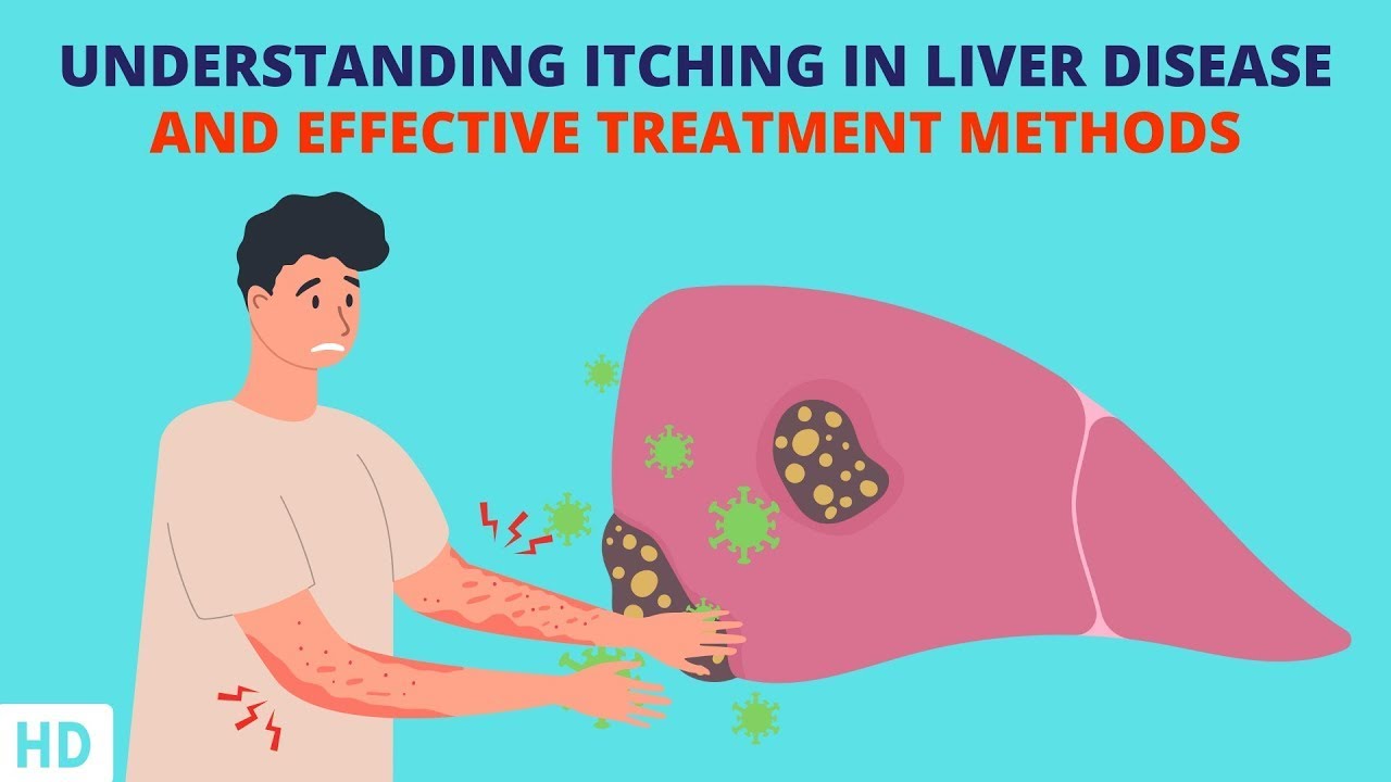 Liver Disease Skin Itching