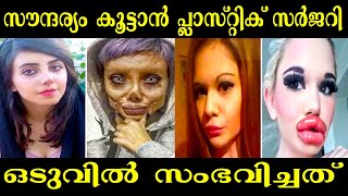 പ്ലാസ്റ്റിക് സർജറി ചെയ്ത് സൗന്ദര്യം കളഞ്ഞവർ / Top Plastic Surgery Fails / malayalam / Mystery Roots