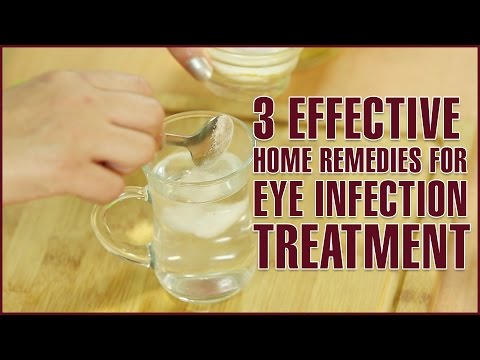 3 Easy & Effective Home Remedies For EYE INFECTION TREATMENT 3 Easy & Effective Home Remedies For EYE INFECTION TREATMENT