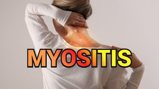 Myositis (updated 2023) - CRASH! Medical Review Series