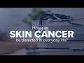 Expert Insights: How can skin cancer be detected in everyday life?