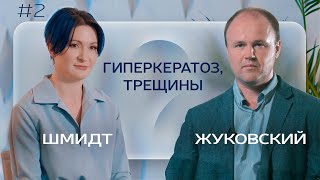 ГИПЕРКЕРАТОЗ и ТРЕЩИНЫ: что нужно знать ПОДОЛОГУ?