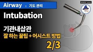 A22 [기도관리] 5. 기관내삽관- 잘하는꿀팁/어시스트 (2/3) ... [Airway management] Intubation