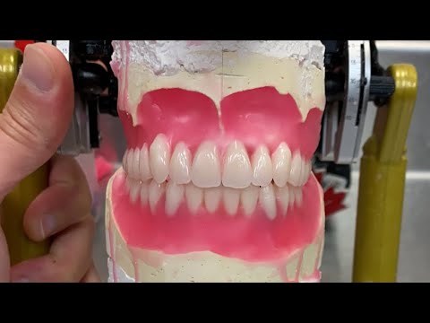 🔴Live Waxing Up Dentures/عربي - YouTube