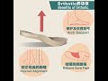 Thomas Chan Orthotic: Shop for Pain-Free Solution