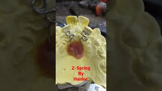 Z-spring of Orthodontic Appliance By Haider..#dentalartbyhaider   #Z-Spring