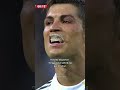 Kenapa Ronaldo pernah gunakan pelindung gigi saat bermain?