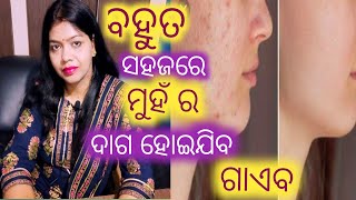 ମୁହଁରେ ବ୍ରଣ ର ଚିହ୍ନ କୁ ଦୂର କରିବାର ଉପାୟ //Facepack for dark spot //Acne spotremoval face pack/odia