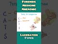 Laceration : Types - mnemonic  | Forensic Medicine , Surgery | #shorts