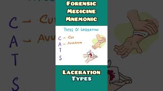 Laceration : Types - mnemonic  | Forensic Medicine , Surgery | #shorts
