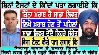 ਬਿਨਾਂ ਲੈਬ ਟੈਸਟ ਇੰਝ ਪਤਾ ਲਾਓ ਕਿੰਨਾ ਖ਼ਰਾਬ ਹੈ ਸਾਡਾ ਲਿਵਰ, ਲਿਖੋ ਖ਼ਰਾਬ ਹੋਣ ਤੋ ਪਹਿਲਾਂ LIVER ਦੇਦੈ ਕਿਹੜੇ ਸੰਕੇਤ!