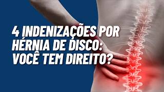 4 Indenizações por Hérnia de Disco: Você Tem Direito?