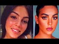 this is why georgina rodriguez did plastic surgery