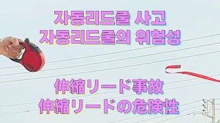 [事故映像] 犬のお散歩に伸縮リードは今すぐやめるべき🐶事故ってしまいまして