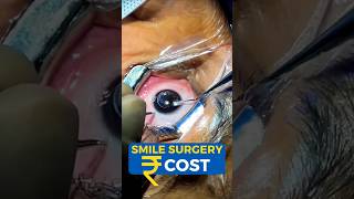 Smile Surgery Cost