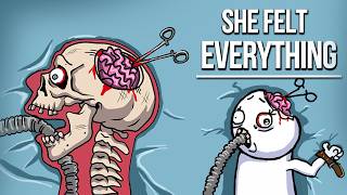 The Worst Surgeries That Went Terribly Wrong