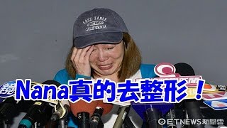 Nana真的去整形！　經紀人揭密「部位」：改一下運也好