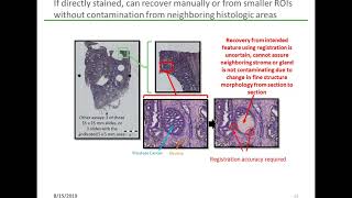 Profiling Focal Areas of FFPE Tissue: Spatial Transcriptomics and the Challenge of Low Input Samples