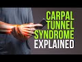 Carpal Tunnel Syndrome Explained in Less Than 8 Minutes