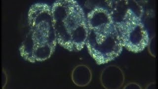 Can I Buy a Cheaper Microscope Online for Live Blood Analysis? - Live Blood Analysis Training Course