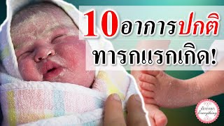 อาการทารก : 10 อาการปกติทารกแรกเกิด | อาการทารกแรกเกิด | เด็กทารก Everything