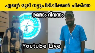 എന്റെ മുടി നട്ടുപിടിപ്പിക്കൽ ചികിത്സ രണ്ടാം ദിവസം 😁