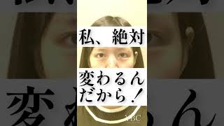 【クマ治療】老けてるなんて言わせない！【切らない目の下のたるみ取り】#shorts